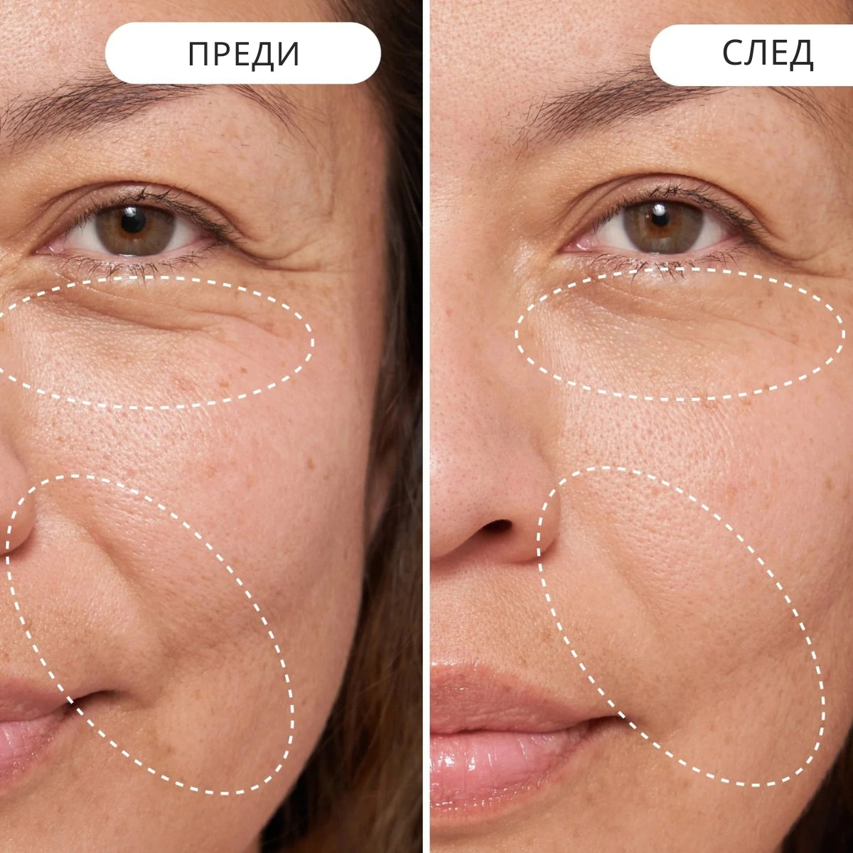 Подмладяващ дневен крем Eternaé - Натурална алтернатива на ретинола