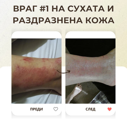 Био крем с колоиден овес при суха и атопична кожа